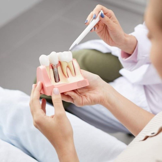 Implantología dental